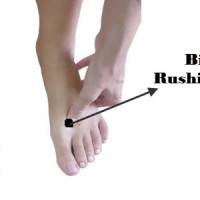 Bigger Rushing Acupressure Points for headaches and Migraine