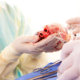 Cardiac Surgery